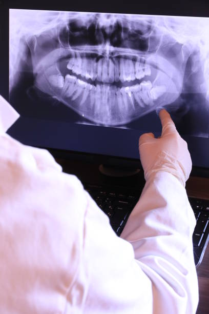 Best Broken or Chipped Tooth Repair in South El Monte, CA